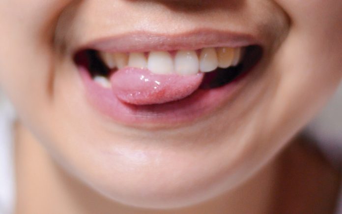 dbe05350458c15fa6c802fb686391131_XL